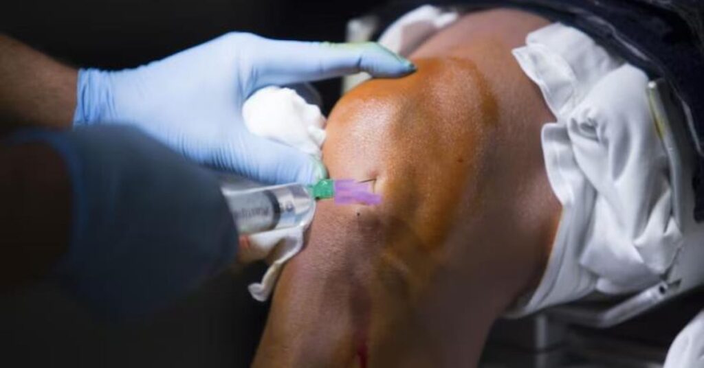 joint replacement in indore, best joint replacement in indore