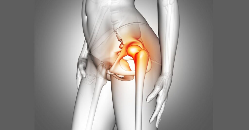 hip replacement in indore